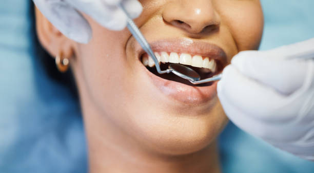 Best Emergency Broken Tooth Repair in Matamoras, OH